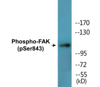 Western blot analysis of extracts from HepG2 cells treated with PMA 125ng/ml 20', using FAK (Phospho-Ser843) Antibody.