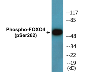 Western blot analysis of extracts from Jurkat cells treated with starved 24h, using FOXO4 (Phospho-Ser262) Antibody.