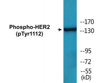 Western blot analysis of extracts from HepG2 cells treated with PMA 125ng/ml 20', using HER2 (Phospho-Tyr1112) Antibody.