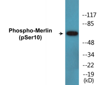 Western blot analysis of extracts from NIH-3T3 cells treated with IFN 2500U/ml 30', using Merlin (Phospho-Ser10) Antibody.