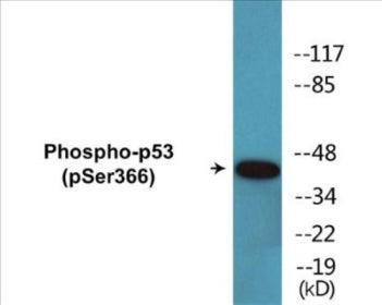 Western blot analysis of extracts from HeLa cells treated with Adriamycin 0.5ug/ml 24h, using p53 (Phospho-Ser366) Antibody.