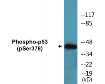 Western blot analysis of extracts from Jurkat cells treated with UV 15', using p53 (Phospho-Ser378) Antibody.