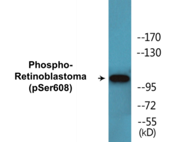 Western blot analysis of extracts from Jurkat cells treated with PMA 125ng/ml 30', using Retinoblastoma (Phospho-Ser608) Antibody.