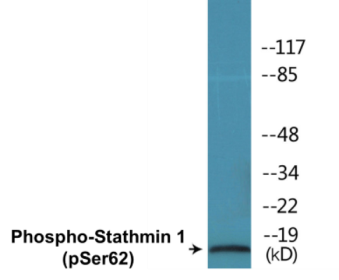 Western blot analysis of extracts from COS7 cells treated with nocodazole 1ug/ml 16h, using STMN1 (Phospho-Ser62) Antibody.