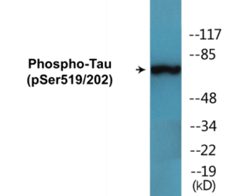 Western blot analysis of extracts from Jurkat cells treated with H2O2 100uM 30', using Tau (Phospho-Ser519/202) Antibody.