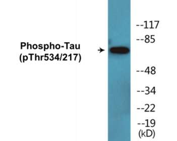 Western blot analysis of extracts from rat brain, using Tau (Phospho-Thr534/217) Antibody.