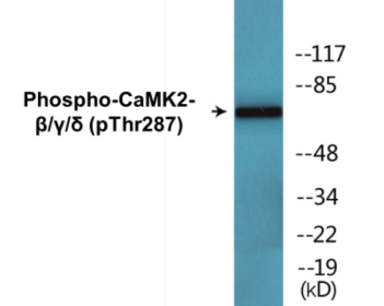 Western blot analysis of extracts from rat brain, using CaMK2-beta/gamma/delta (Phospho-Thr287) Antibody.