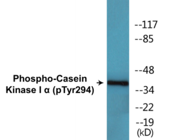 Western blot analysis of extracts from HT29 cells treated with heat shock, using CK-1 alpha (Phospho-Tyr294) Antibody.