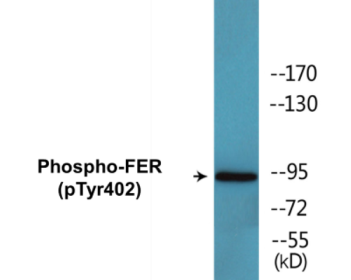 Western blot analysis of extracts from Jurkat cells treated with starved 24h, using FER (Phospho-Tyr402) Antibody.