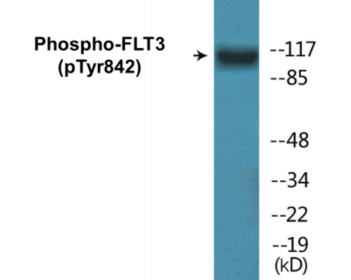 Western blot analysis of extracts from HepG2 cells treated with EGF 200ng/ml 30', using FLT3 (Phospho-Tyr842) Antibody.