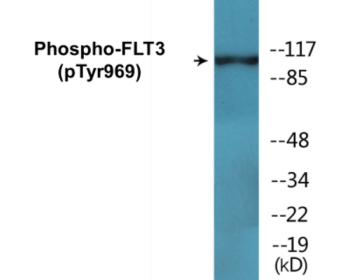 Western blot analysis of extracts from HepG2 cells treated with Na3VO4 0.3mM 40', using FLT3 (Phospho-Tyr969) Antibody.