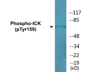 Western blot analysis of extracts from NIH-3T3 cells treated with starved 24h, using ICK (Phospho-Tyr159) Antibody.