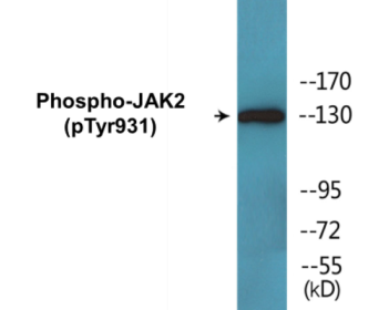 Western blot analysis of extracts from HepG2 cells treated with Na3VO4 0.3mM 40', using JAK2 (Phospho-Tyr931) Antibody.
