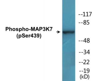 Western blot analysis of extracts from Jurkat cells treated with PMA 125ng/ml 30', using MAP3K7 (Phospho-Ser439) Antibody.