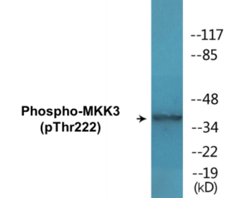 Western blot analysis of extracts from Jurkat cells treated with serum 20% 15', using MAP2K3 (Phospho-Thr222) Antibody.