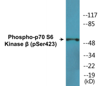 Western blot analysis of extracts from K562 cells treated with EGF 200ng/ml 5', using p70 S6 Kinase beta (Phospho-Ser423) Antibody.