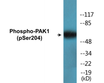Western blot analysis of extracts from NIH-3T3 cells treated with UV 15', using PAK1 (Phospho-Ser204) Antibody.