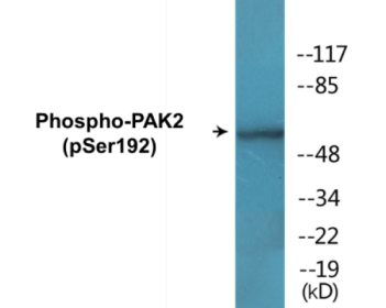 Western blot analysis of extracts from HeLa cells, using PAK2 (Phospho-Ser192) Antibody.