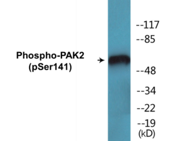Western blot analysis of extracts from HepG2 cells treated with Adriamycin 0.5uM 24h/Jurkat cells treated with PMA 125ng/ml 30', using PAK2 (Phospho-Ser141) Antibody.