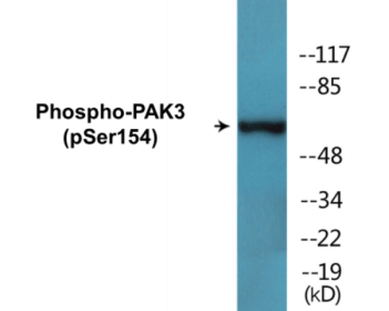 Western blot analysis of extracts from rat heart, using PAK3 (Phospho-Ser154) Antibody.