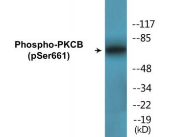 Western blot analysis of extracts from HeLa cells treated with heat shock, using PKCB (Phospho-Ser661) Antibody.