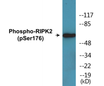 Western blot analysis of extracts from 293 cells treated with UV 15', using RIPK2 (Phospho-Ser176) Antibody.