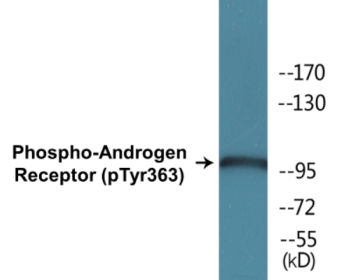 Western blot analysis of extracts from Jurkat cells treated with UV 15', using Androgen Receptor (Phospho-Tyr363) Antibody.