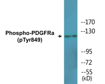 Western blot analysis of extracts from 293 cells, using PDGFRa (Phospho-Tyr849) Antibody.