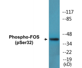 Western blot analysis of extracts from Jurkat cells treated with starved 24h, using FOS (Phospho-Ser32) Antibody.