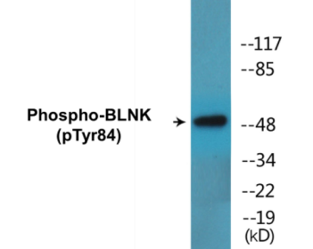 Western blot analysis of extracts from K562 cells treated with starved 24h, using BLNK (Phospho-Tyr84) Antibody.