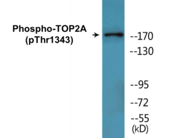 Western blot analysis of extracts from HepG2 cells treated with Ca2+ 40nM 30', using TOP2A (Phospho-Thr1343) Antibody.