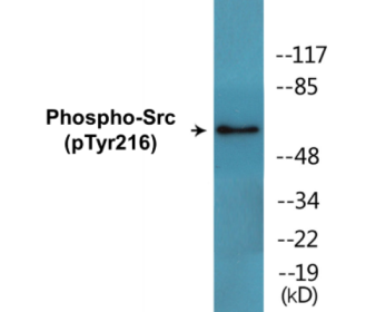 Western blot analysis of extracts from Jurkat cells treated with EGF 200ng/ml 5', using Src (Phospho-Tyr216) Antibody.