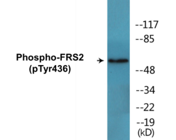 Western blot analysis of extracts from COS7 cells , using FRS2 (Phospho-Tyr436) Antibody.