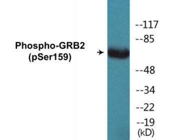 Western blot analysis of extracts from HT29 cells treated with serum 20% 15', using GRB2 (Phospho-Ser159) Antibody.
