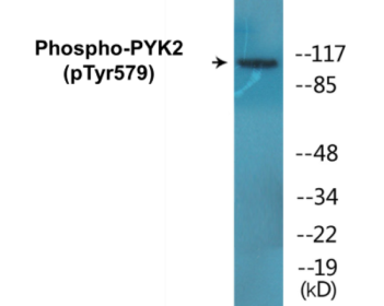 Western blot analysis of extracts from NIH-3T3 cells, using PYK2 (Phospho-Tyr579) Antibody.