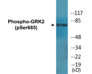 Western blot analysis of extracts from HT29 cells treated with insulin 0.01U/ml 15', using GRK2 (Phospho-Ser685) Antibody.