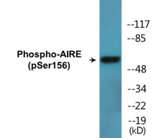 Western blot analysis of extracts from HeLa cells treated with Hu 2nM 24h, using AIRE (Phospho-Ser156) Antibody.