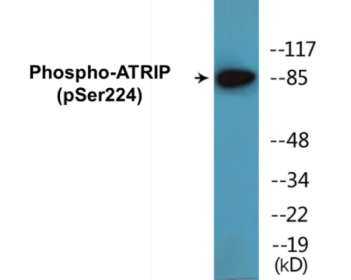 Western blot analysis of extracts from 293 cells treated with UV 15', using ATRIP (Phospho-Ser224) Antibody.