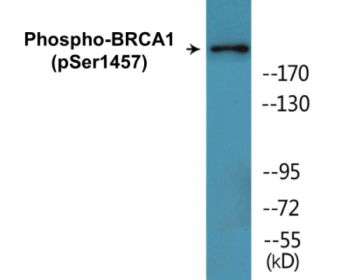 Western blot analysis of extracts from 293 cells treated with epo 20U/ml 15', using BRCA1 (Phospho-Ser1457) Antibody.