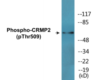 Western blot analysis of extracts from HT29 cells treated with heat shock, using CRMP-2 (Phospho-Thr509) Antibody.