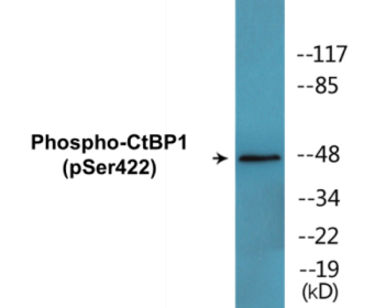 Western blot analysis of extracts from Jurkat cells treated with TNF 20ng/ml 30' and Jurkat cells treated with UV 15', using CtBP1 (Phospho-Ser422) Antibody.
