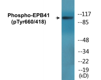Western blot analysis of extracts from HepG2 cells treated with PMA 125ng/ml 30', using EPB41 (Phospho-Tyr660/418) Antibody.