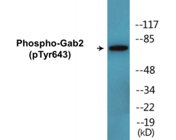 Western blot analysis of extracts from Jurkat cells treated with IFN 2500U/ML 30', using Gab2 (Phospho-Tyr643) Antibody.