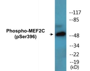 Western blot analysis of extracts from NIH-3T3 cells treated with starved 24h, using MEF2C (Phospho-Ser396) Antibody.