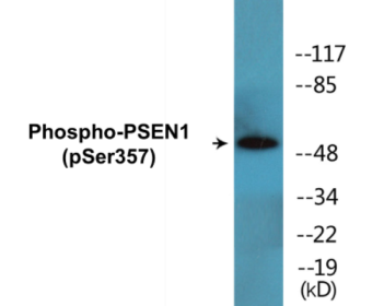 Western blot analysis of extracts from RAW264.7 cells treated with UV 5', using PSEN1 (Phospho-Ser357) Antibody.