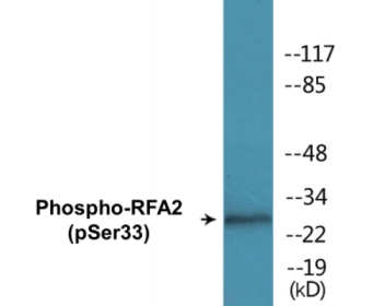Western blot analysis of extracts from NIH-3T3 cells treated with Adriamycin 0.5ug/ml 24h, using RFA2 (Phospho-Ser33) Antibody.