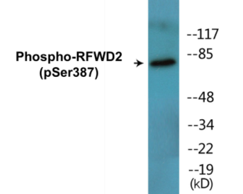 Western blot analysis of extracts from K562 cells treated with UV 15', using RFWD2 (Phospho-Ser387) Antibody.