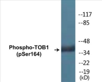 Western blot analysis of extracts from HT29 cells treated with serum 20% 15', using TOB1 (Phospho-Ser164) Antibody.