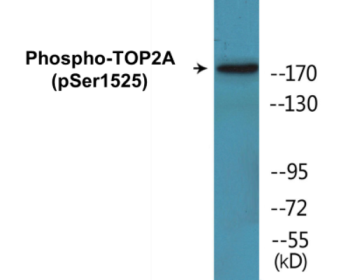 Western blot analysis of extracts from RAW264.7 cells treated with TNF 20ng/ml 5', using TOP2A (Phospho-Ser1525) Antibody.