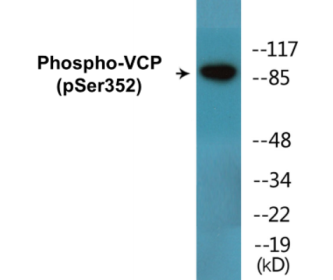 Western blot analysis of extracts from NIH-3T3 cells treated with starved 24h, using VCP (Phospho-Ser352) Antibody.